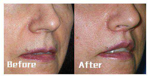 失望型分手如何有效挽回前任，别乱用断联，容易错失良机